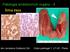 Patologie endokrinních orgánů - II. Štítná žláza