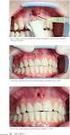 Klíčová Klíčova slova: apikálni apikální resorpce, intruze, retrakce, nivelizace Key Words: apical resorption, intrusion, retraction, leveling