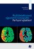 Hynek Mírka Jiří Ferda. Multidetektorová výpočetní tomografie Perfuzní vyšetření