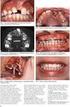 Problematika třetích molárů a dentální hygiena The issue of third molars and dental hygiene