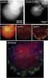 SIMULATION OF TRANSPORT NANOIRON PARTICLE AND DESTRUCTION OF CHLORINATED HYDROCARBONS CONTAMINANTS IN POROUS MEDIA