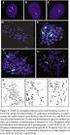 Molecular-cytogenetic analysis of chromosome 11 aberrations in hematological malignancies