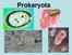 Stavba prokaryotické buňky