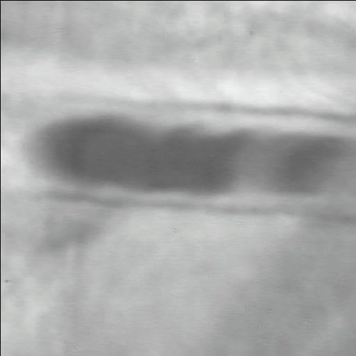 Limited interaction of blood with endothelial