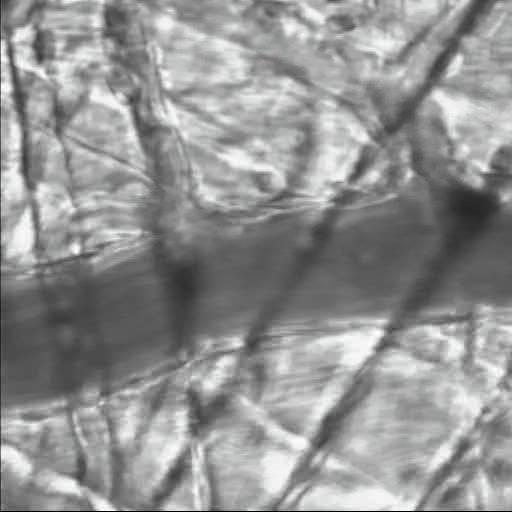 Increased leukocyte adhesion after enzyme degradation of the