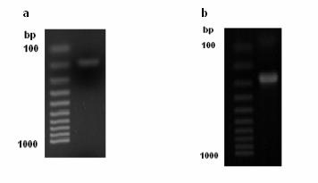 Graf 7: Relativní zastoupení mrna jednotlivých podtypů muskarinových receptorů v myší mozkové kůře, udáno v procentech ± SEM.