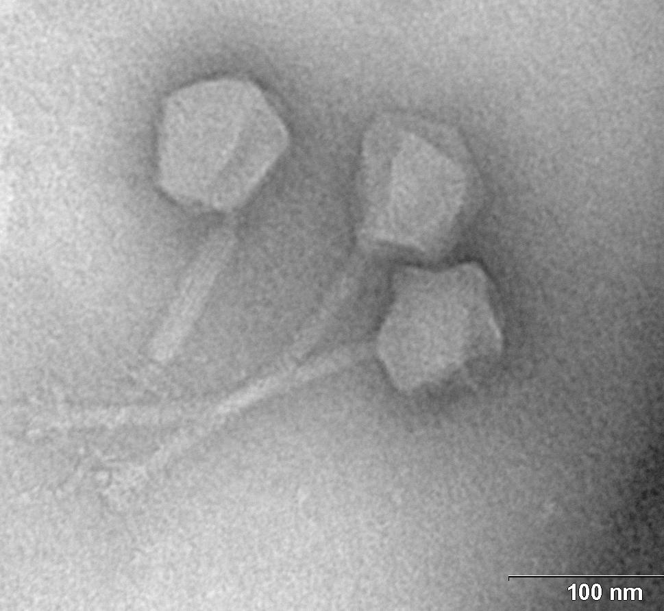 MRSA infekcí