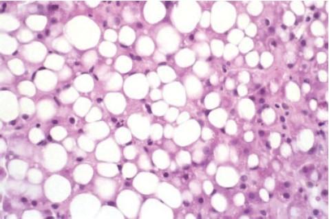 Histologické
