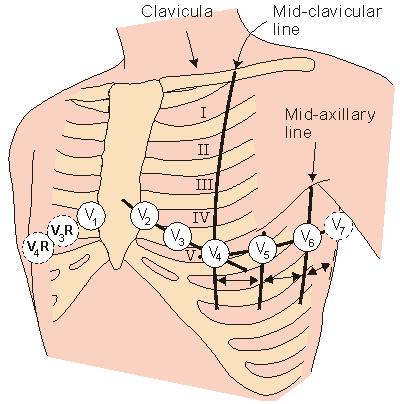 EKG svody Hrudní