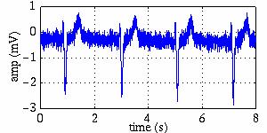 většinou nad 35 Hz (do 5 khz) rychlé (skokové) změny izoline