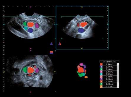 práce. 8 Široká škála možností více současných pohledů ukazuje řezy s vysokým rozlišením, díky čemuž lze lépe pochopit anatomické souvislosti a rozsah dané léze.