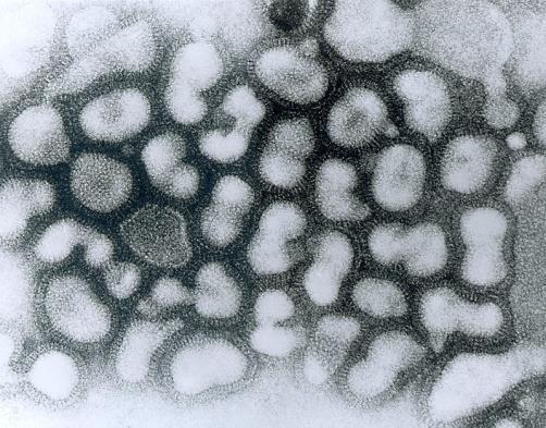 CHŘIPKA chřipka - onemocnění způsobené RNA virem (Orthomyxoviridae) (průměrná velikost viru 80nm) typy chřipkových virů: typ A (infikují savce a ptáky) typ B (infikují převážně lidi) typ C