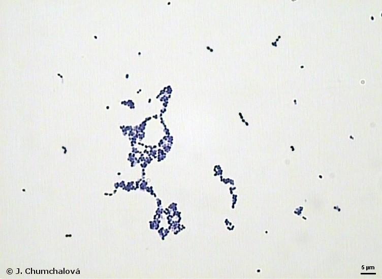 (48 h při 30 o C). [42] Obr. 6. Lactococcus lactis subsp.