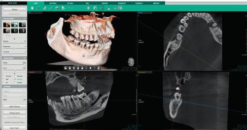 PaX-i 3D SMART: CT S MOŽNOSTÍ UPGRADU FOV Značka Vatech představila na veletrhu IDS v Kolíně nad Rýnem oblíbený CT rentgen s řadou inovací.