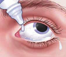 4 4x times 4 4 x 4 pads pads daily 3 days prior 4 x 4 pads agentagent drapedrape Pupillary agent drape Povidone Povidone 0% 0% caliper caliper Povidone 0% caliper Povidone Povidone Povidone Příprava