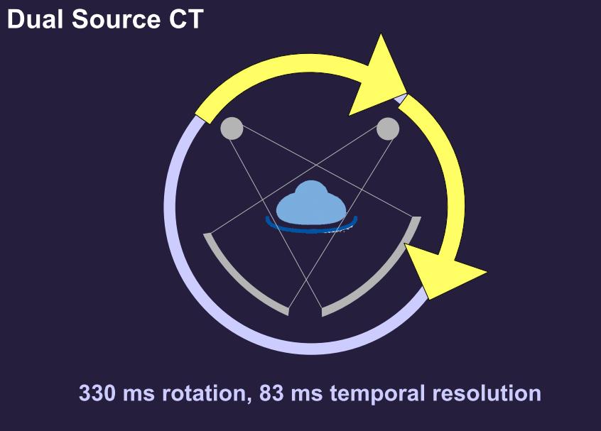 Technika CT další zásadní pokrok - DSCT - 2 zdroje a dva detektory, k