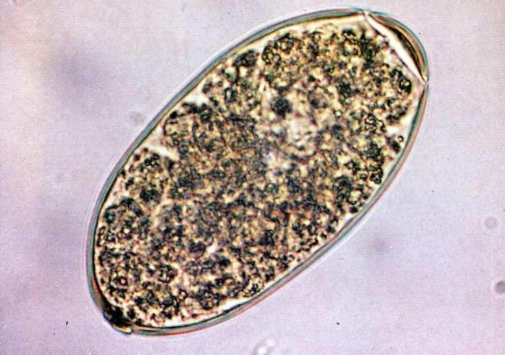 14 Obr. 3 Vajíčko motolice Fasciola hepatica Převzato z: http://research.vet.upenn.edu/hosts/fasciolahepatica/tabid/7869/default.aspx 3.1.3 Parazitózy způsobené tasemnicemi Tasemničnatost Toto onemocnění vyvolává ve většině případů rod Moniezia (viz Obr.