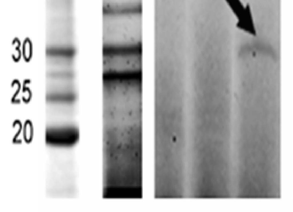 Tato reakce nebyla detekována u vzorků preinkubovaných s inhibitorem E- 64 ani u samotného vzorku ES produktů bez DCG-04 (Obr. 17).