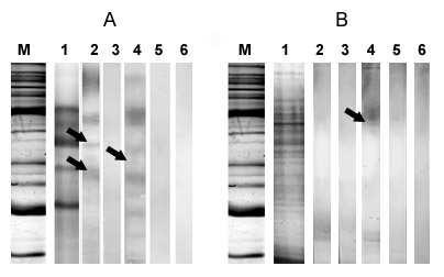 Obr. 24. Imunoblot s ES proteiny F. magna a F. hepatica po 1-DE s jelením/kozím sérem z parazitovaných zvířat. 1; proteinový profil ES produktů F. magna a F. hepatica (12% 1mm polyakrylamidový gel barven Coomassie Bio-Safe).