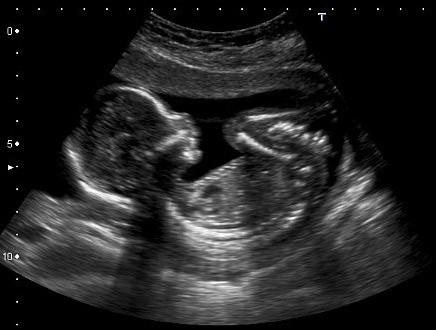 PROSTŘEDÍ A ZKUŠENOSTI S NÍM JAKO DETERMINANTY VNÍMÁNÍ Percepční sety: percepční