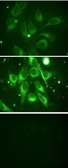 A B C Obrázek 1: Srovnání fluorescence kultur buněk fibroblastů po inkubaci s různými formami kurkuminu (A nativní kurkumin, B kurkumin se zmenšenou velikostí částic, C Neo curcumin ODT supplement) 2.