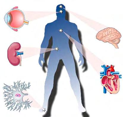 Obr. 3: Mikro a makrovaskulární komplikace pacientů s DM z U diabetiků s periferní neuropatií pomáhá nejvíce pravidelné aerobní cvičení, které může zabránit nástupu nebo progresi periferní neuropatie.