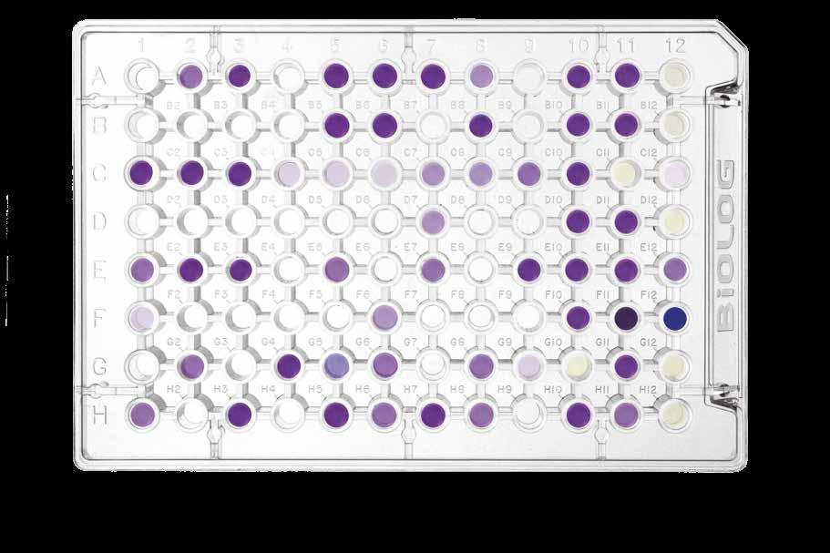 Parametry Systém založený nejen na metabolické odezvě, ale i testech citlivosti a kinetice.