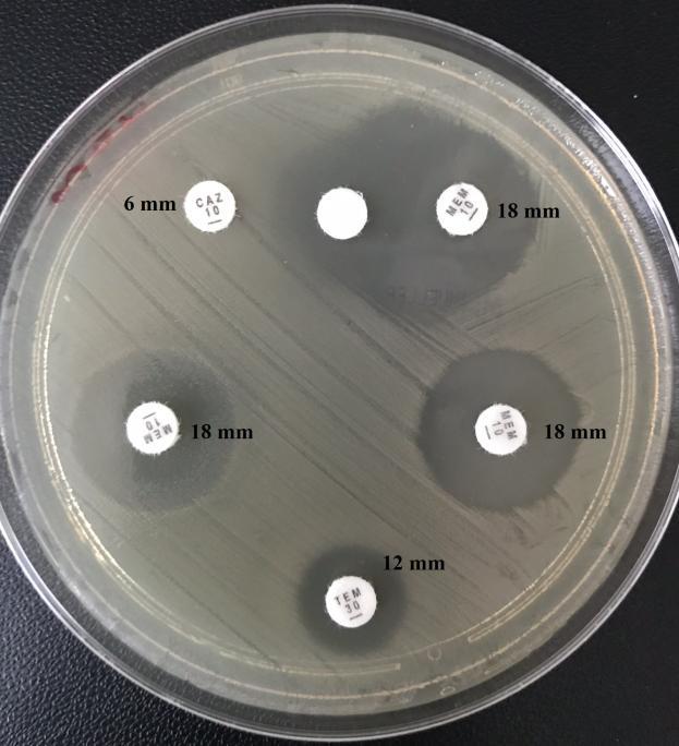 8.2.2 Skupina B Metalo-ß-laktamasy hydrolyzují peniciliny, cefalosporiny I. IV. generace a karbapenemy. Nehydrolyzují aztreonam.