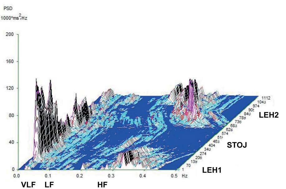 R. Metelka et al. 405 rozdílu bylo doplněno hodnocení i po dekádách (41 50 let: n = 15, 51 60 let: n = 15).