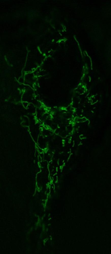 5.2 Test fluorescence mitochondrií Dalším kontrolním krokem před pozorováním nanočástic bylo zjistit, jak v KM vypadají mitochondrie.