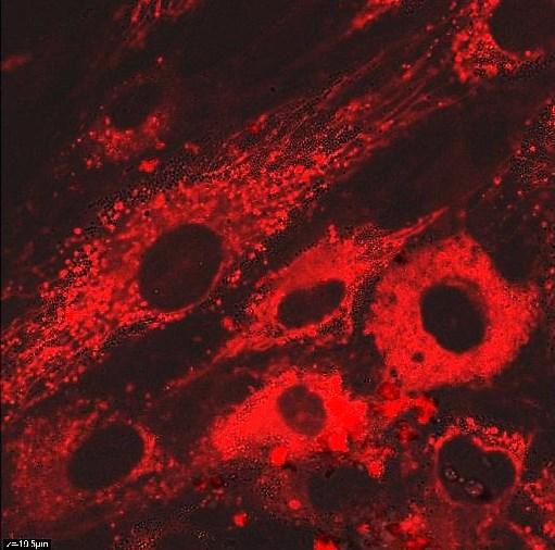 Obrázek 23: Samotné FeNV-R v MSC buňkách. Podlouhlé červené "řetízky" jsou mitochondrie, které vyznačil rhodamin. Skutečné FeNV-R jsou malé, kulaté útvary, což jsou shluky FeNV-R v lysozomech. 6.2.1 Analýza kolokalizace mitochondrií a QCD Úvodem se dá obecně říct, že umístění mitochondrií a QCD se po úpravě spekter moc neshodovalo, což je z hlediska toxicity dobrá zpráva.