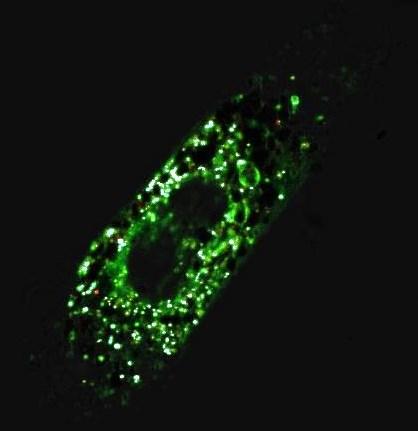 Obrázek 26: Zajímavý snímek dělící se buňky. Zeleně jsou značeny lysozomy, pár červených pixelů značí samotné nanočástice a modře je vykreslena kolokalizace.