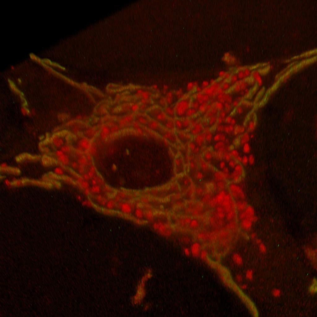 Obrázek 33: 3D zoobrazení 10 rovin jiné buňky (Leica software). Stejně jako v předchozím obrázku jsou červeně barveny FeNv-R a žluto-zeleně mitochondrie.