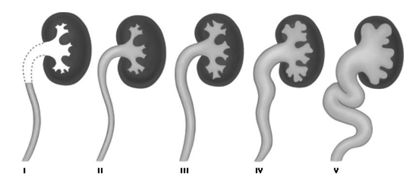 MCUG diagnostika a sledování VUR https://pediatrics.