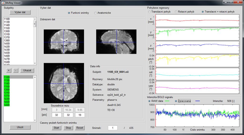 8.1 MoReg_Viewer Grafické uživatelské rozhraní, graphical user interface (GUI), programu MoReg_Viewer.m se skládá celkem z šesti panelů, viz Obrázek 25.