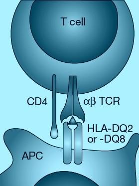 Obrázek 6 Schéma mezi APC a T-lymfocytem při prezentaci antigenu (http://www1.lf1.cuni.cz/~kocna/glab.htm#celiak) Peptidové fragmenty představují APC rozložené exogenní antigeny.