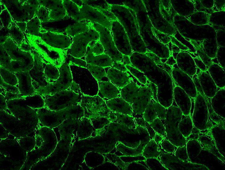 Obrázek 13 protilátky proti retikulinu (ARA), originální mikrofoto IIF