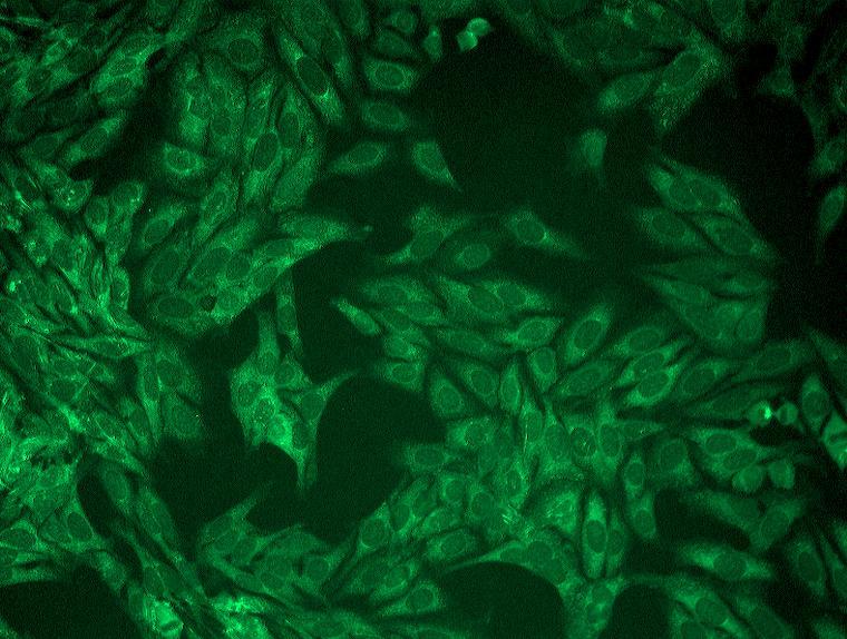 set EUROIMUNN, SRN) Obrázek 14 protilátky proti cytoplasmě