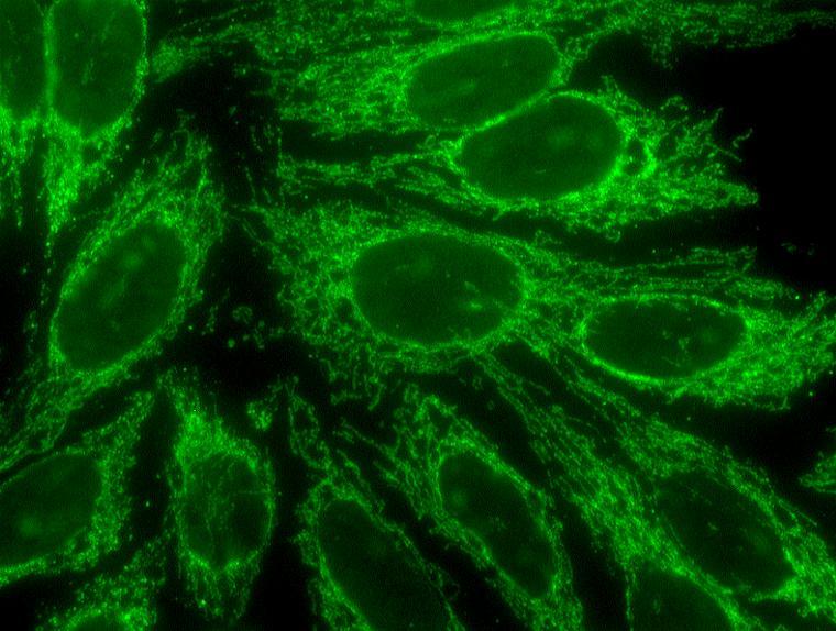 Obrázek 17 protilátky proti mitochondriím (AMA), originální mikrofoto IIF