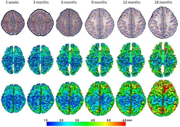 H. et al. (2011) STRES V DĚTSTVÍ Na začátku života mozek prochází mnoha citlivými obdobími vývoje.