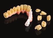 Initial Zr-FS Advanced Set 46 350 Kč 877011: 11 INside, 5 Cervical Translucent, 3 Enamel Occlusal, 4 Enamel Opal, 7 Shoulder Transpa, 3 Shoulder Opaque, 3x Fluo Dentin, Gingival Universal, Correction