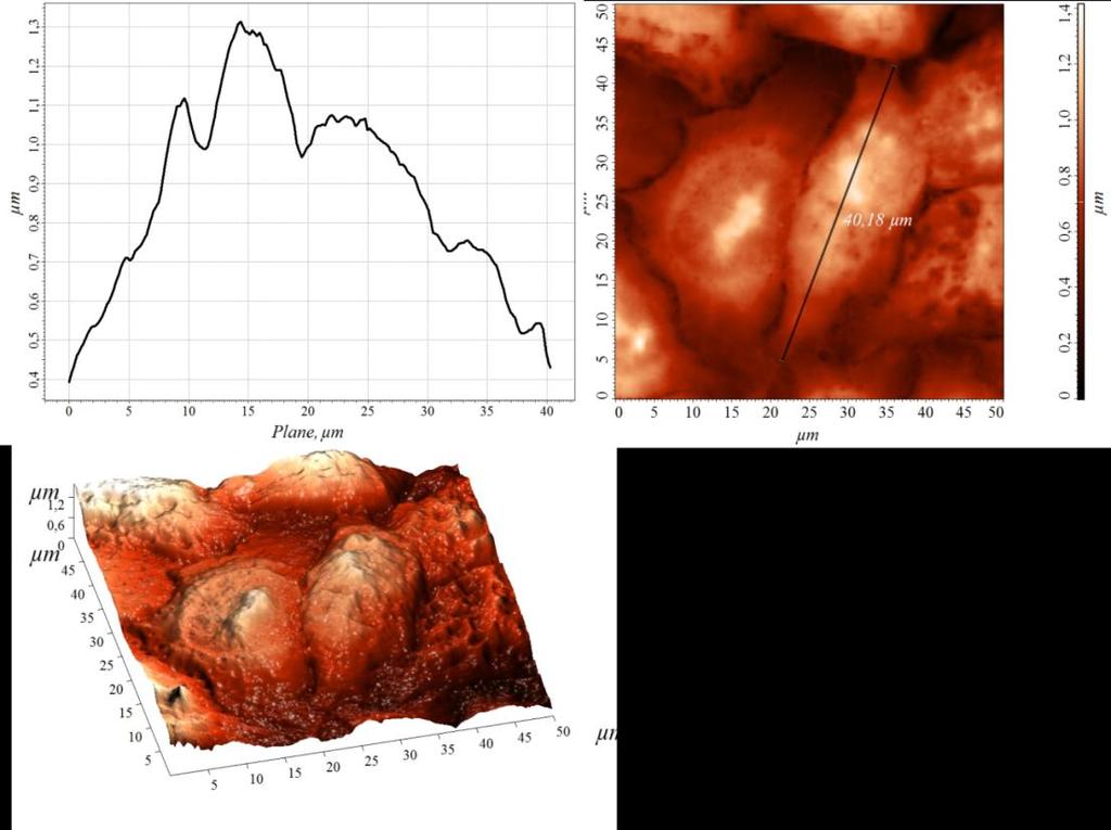 2D AFM před PDT Buňky tvoří monovrstvu Liniový profil Liniový profil 3D AFM zobrazení HeLa buňečné