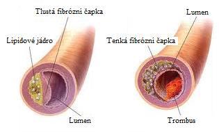 (obrázek přetištěn se souhlasem firmy diadexus, Inc.