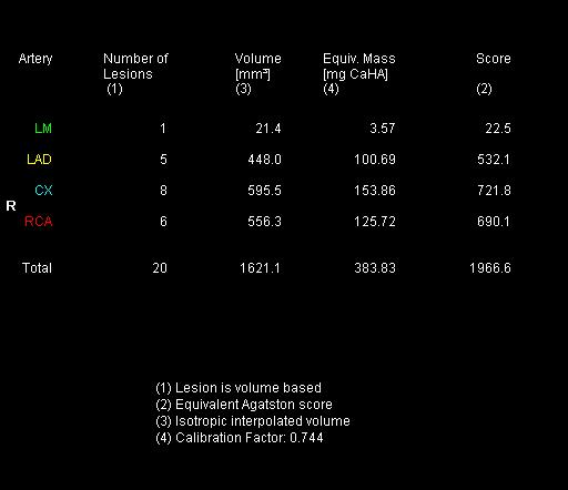 Manuálně označené kalcifikace byly programem Ca scoring analyzovány. Byl určen jejich počet, objem a obsah hydroxyapatitu v miligramech.