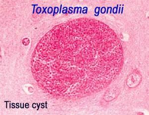 Toxoplasma gondii http://webdb.dmsc.moph.go.t h/ifc_nih/applications/pics/tox oplasma.