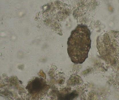 Střevní paraziti II Vajíčko škrkavky Obrázky