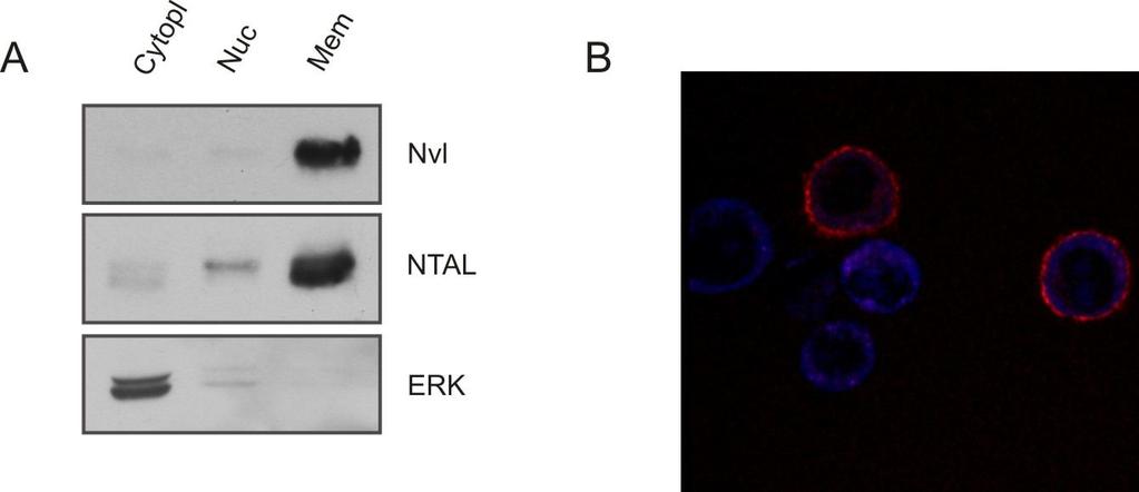 4. Results 4.1 Membrane localization of Nvl Analysis of Nvl amino acid sequence found in public databases suggested that Nvl is a transmembrane protein.