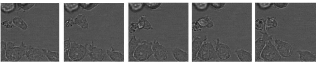 After adding a chemo-attractant some cells started to move, in these migrating cells Nvl relocalized into the trailing edge of the cell to uropod (Fig.