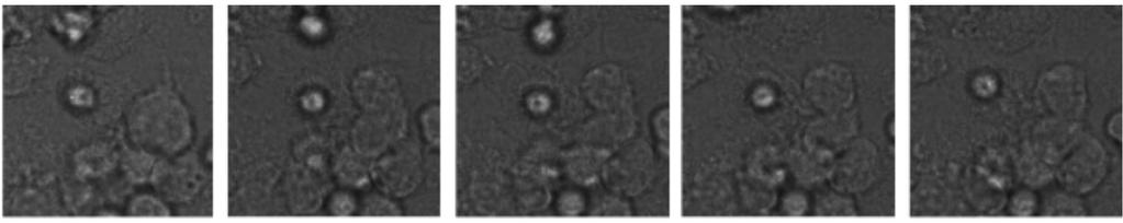 Both cell migration and division are examples of cell polarization.