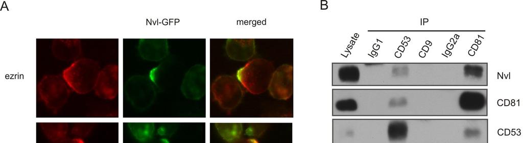 We could conclude that Nvl is localized on cell surface in TEMs with direct association with at least some members of tetraspanin family (CD53, CD81). Fig.